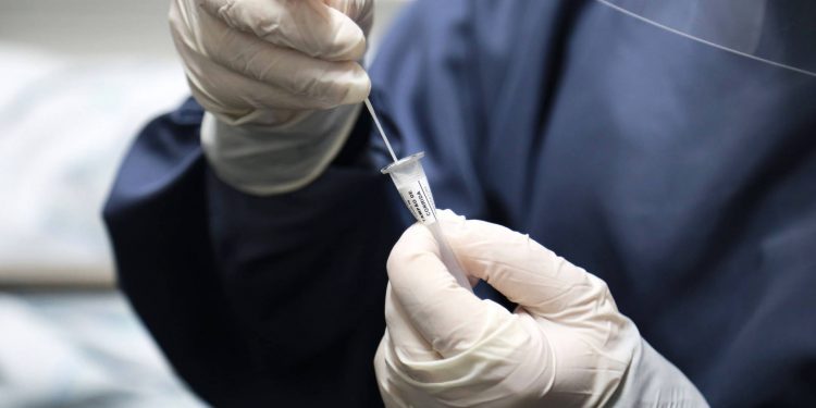 Estado distribui testes rápidos e oxímetros para municípios das 22 Regionais de Saúde