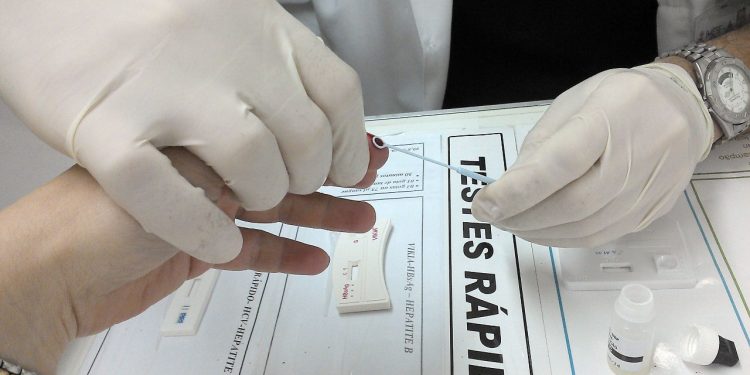 Testes de hepatites nesta semana no Serviço de Atendimento Especializado