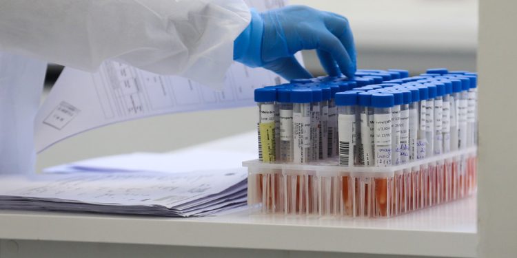 Paraná confirma 113 novos casos e mais três óbitos de H3N2