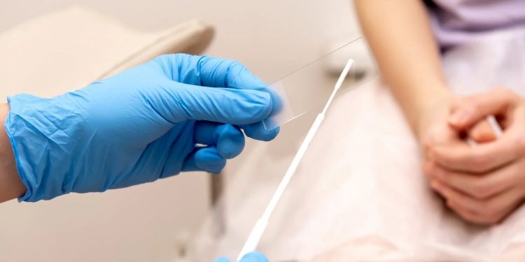 Campanha de exames preventivos será realizada em oito Unidades Básicas de Saúde de Campo Mourão, na quarta-feira (21)